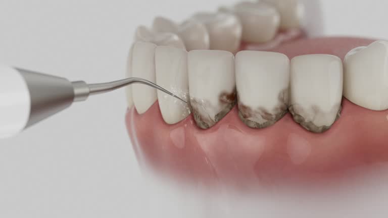 Trusted Dental Crowns And Bridges service in Glandorf, OH - Dentist Open Now